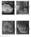 Fig. 03 - Delayed release pharmaceutical formulation and methods of making and using same