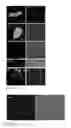 Fig. 09 - POLYMER NANOCAPSULES FOR PROTEIN DELIVERY