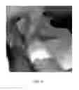 Fig. 03 - Solid-forming topical formulations for pain control