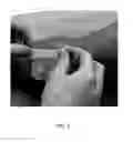 Fig. 05 - Solid-forming topical formulations for pain control