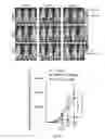 Fig. 08 - Cancer treatment method using ailanthone compounds