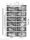 Fig. 19 - CDC7 kinase inhibitors and uses thereof