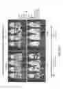 Fig. 27 - CDC7 kinase inhibitors and uses thereof