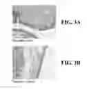 Fig. 04 - MICROBICIDAL COMPOSITION COMPRISING AN OCTOXYNOL AND A QUINOLIZIDINE ALKALOID COMPOUND OR A SOURCE THEREOF