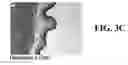 Fig. 05 - MICROBICIDAL COMPOSITION COMPRISING AN OCTOXYNOL AND A QUINOLIZIDINE ALKALOID COMPOUND OR A SOURCE THEREOF