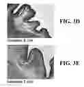 Fig. 06 - MICROBICIDAL COMPOSITION COMPRISING AN OCTOXYNOL AND A QUINOLIZIDINE ALKALOID COMPOUND OR A SOURCE THEREOF