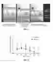 Fig. 05 - Compositions and methods for treatment related to fall and fall frequency in neurodegenerative diseases