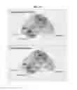 Fig. 17 - Treatment of relapsed and/or refractory solid tumors and non-hodgkin's lymphomas