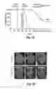 Fig. 04 - Compositions and methods for treatment of glioma