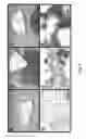 Fig. 02 - Decellularized Adipose Cell Growth Scaffold