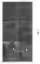 Fig. 04 - Decellularized Adipose Cell Growth Scaffold