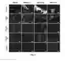 Fig. 05 - Decellularized Adipose Cell Growth Scaffold