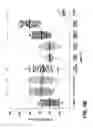 Fig. 08 - Methods for treating ulcerative colitis