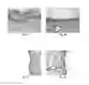Fig. 02 - METHODS AND COMPOSITIONS FOR BONE AND CARTILAGE REPAIR