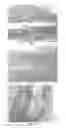 Fig. 04 - METHODS AND COMPOSITIONS FOR BONE AND CARTILAGE REPAIR
