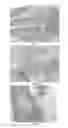 Fig. 06 - METHODS AND COMPOSITIONS FOR BONE AND CARTILAGE REPAIR