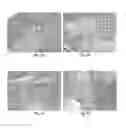Fig. 12 - METHODS AND COMPOSITIONS FOR BONE AND CARTILAGE REPAIR