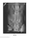 Fig. 15 - METHODS AND COMPOSITIONS FOR BONE AND CARTILAGE REPAIR