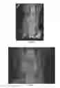 Fig. 16 - METHODS AND COMPOSITIONS FOR BONE AND CARTILAGE REPAIR