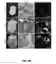 Fig. 07 - Therapy