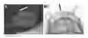 Fig. 01 - 9-OH-risperidone controlled release composition