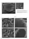 Fig. 04 - Preparing method of nerve conduits including cells