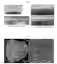 Fig. 06 - Preparing method of nerve conduits including cells