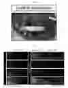 Fig. 14 - Preparing method of nerve conduits including cells