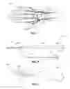 Fig. 02 - Sheath Introducer For Peripheral Artery Catheterization Procedures