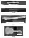 Fig. 07 - Development and Vascular Applications of Shape Memory External Stents