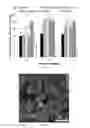 Fig. 09 - Development and Vascular Applications of Shape Memory External Stents