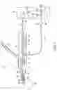 Fig. 02 - Vacuum control method for surgical hand piece