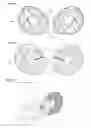 Fig. 07 - Automated Compression Nursing And Pumping System