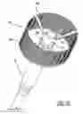 Fig. 09 - Intravascular ventricular assist device