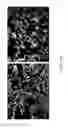 Fig. 25 - Cartridge and method for increasing myocardial function