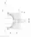 Fig. 44 - Adhesive and peripheral systems and methods for medical devices