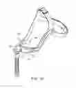 Fig. 45 - Nasal assembly