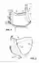 Fig. 02 - Headgear for masks