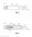 Fig. 07 - Intravascular device delivery sheath