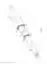 Fig. 02 - Telescoping catheter