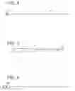 Fig. 04 - Implantable Stent