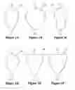 Fig. 02 - HAND-HELD FLUID-SUBSTANCE APPLICATOR