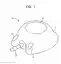 Fig. 02 - Volume reducing reservoir insert for an infusion port