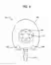 Fig. 07 - Volume reducing reservoir insert for an infusion port