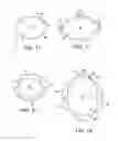 Fig. 08 - Implantable medical device for improved placement and adherence in the body