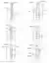 Fig. 05 - Electrodes and electrode positioning systems for transvascular neuromodulation