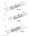 Fig. 08 - Electrical stimulation leads, systems and methods for stimulation of dorsal root ganglia