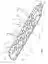 Fig. 06 - Implantable lead with flexible paddle electrode array