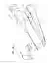 Fig. 06 - Delivery of implantable neurostimulators