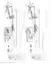 Fig. 09 - Delivery of implantable neurostimulators